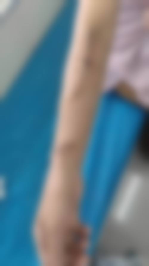 北流悦莱美医疗美容诊所价格表