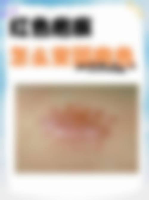 杭州悦可医疗美容诊所陈彩媛好预约吗——重庆现代女子医院整形美容科