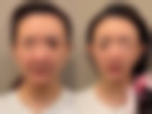 太原恩喜枫芸整形医院项目特色