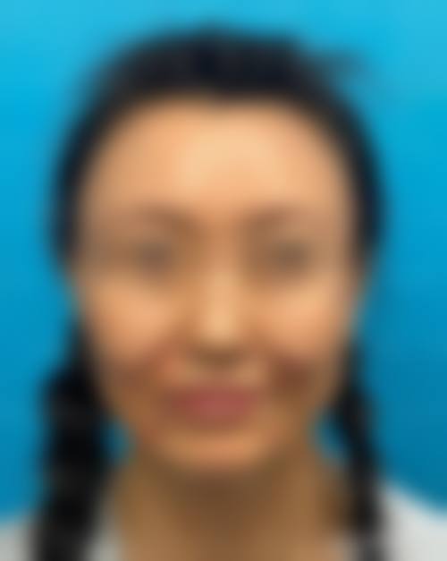 南方医院整形美容外科怎么样之项目特色