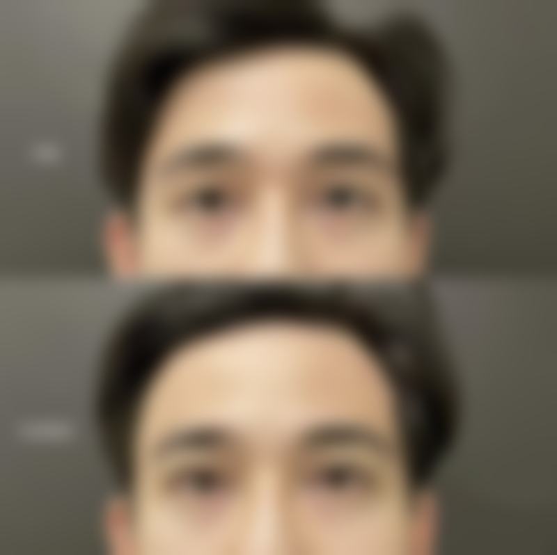 韩国医美项目价格揭秘,浪漫江南透明比价