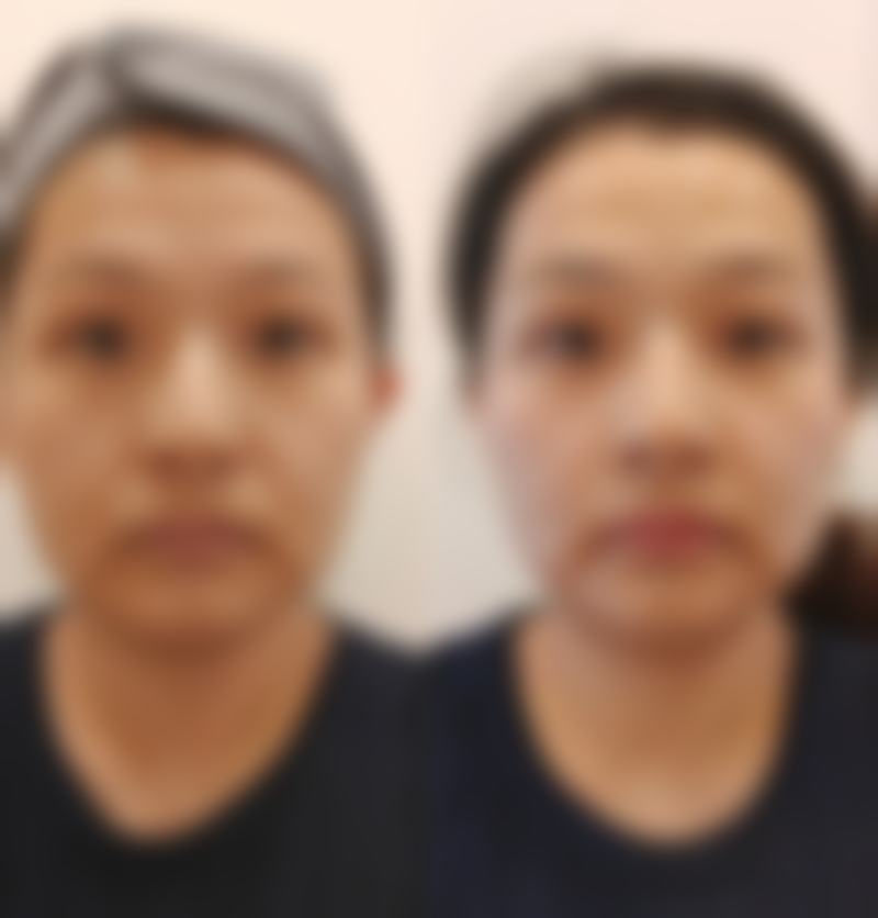 太原华妍毓秀整形医院价格表