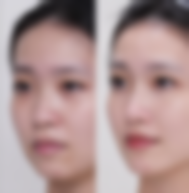 钱征医生口碑如何