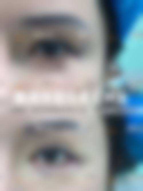 朱黎明医生口碑如何