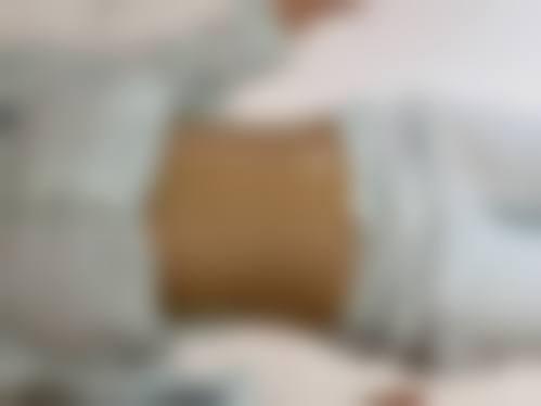 温莲香医生简介做手术价格