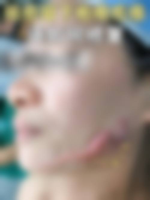 桂林新华医疗美容门诊部顾客实例