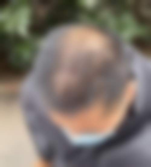 卜忠兴医生口碑如何