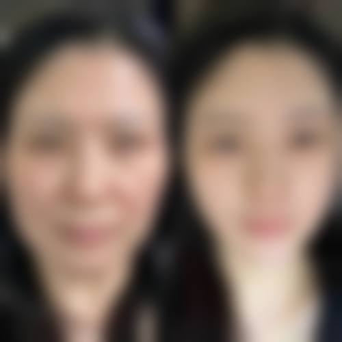 朴俊英医生顾客实例图片