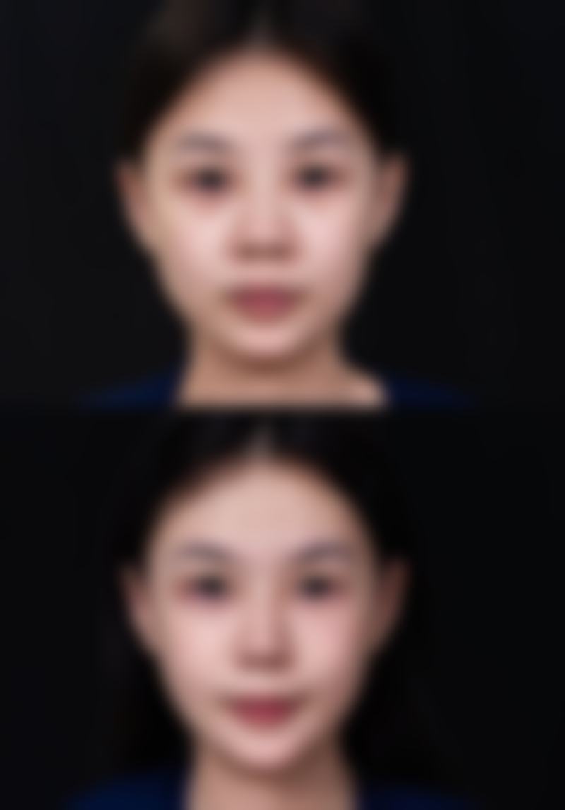 温莲香医生简介项目优势