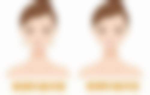 上海市赵珮娟在上海德琳医疗美容医院（韩国Dream分院）多少钱——上海德琳医疗美容医院（韩国Dream分院）