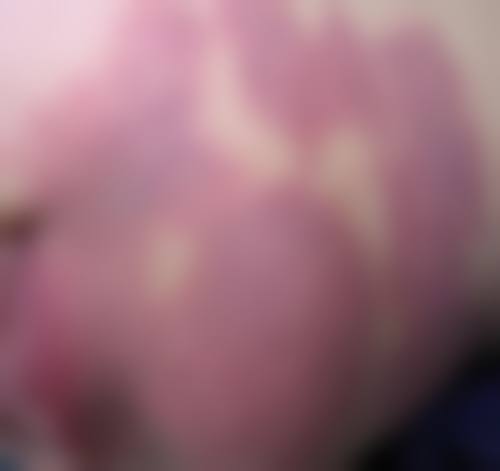 乳山奥美涵熙整形医院项目特色