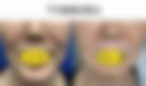 深圳医嘉整形医院项目特色
