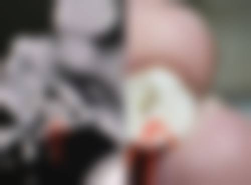 陈垚医生简介做手术价格