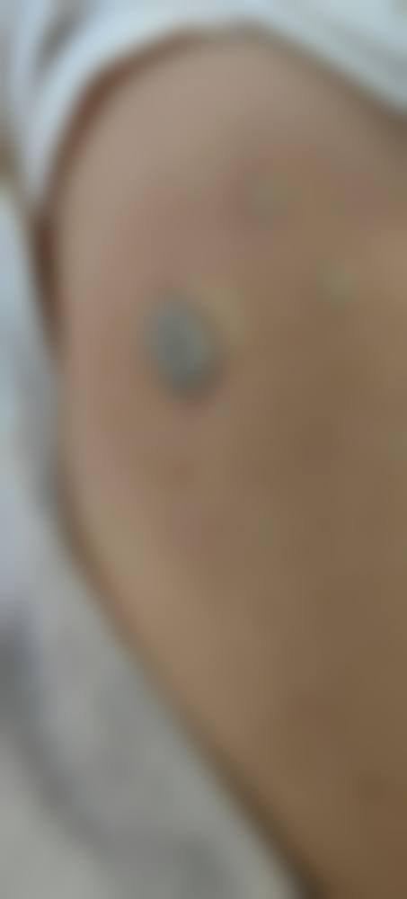何成君医生简介做手术价格