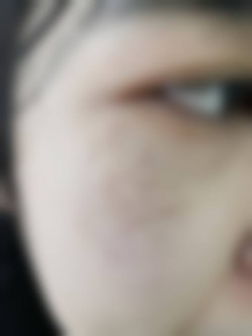 何成君医生简介怎么挂号