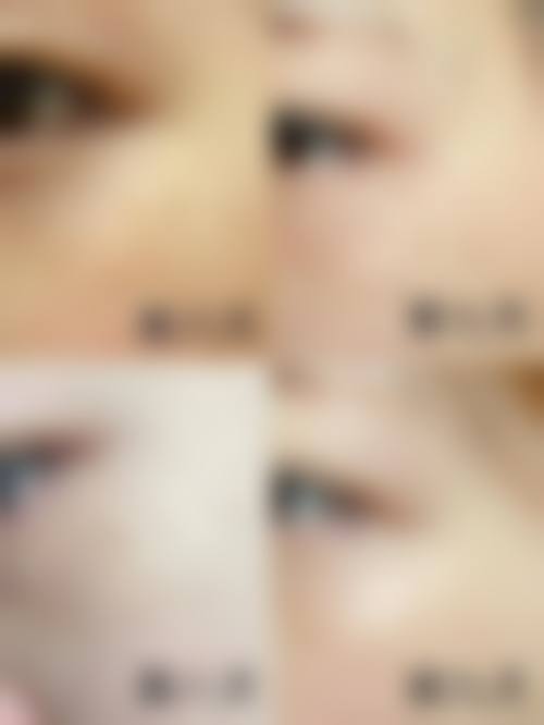 程亚萍医生项目优势