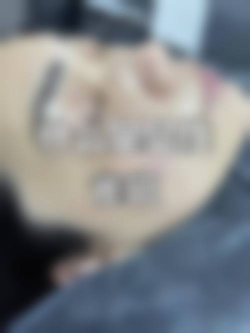 邹立新医生顾客实例图片