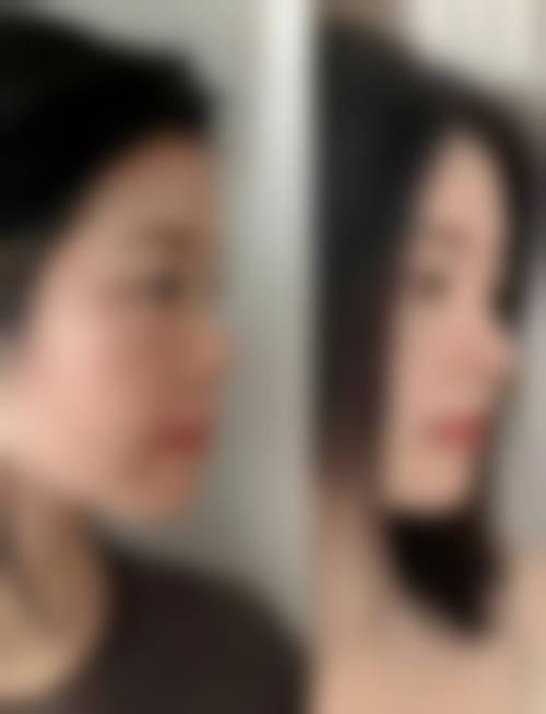 合肥医美行业监管动态