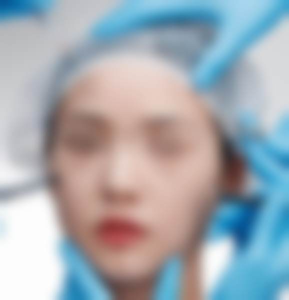 周金娟医生做手术价格