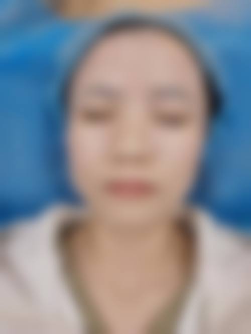 安徽省立友谊医院整形美容外科价格表