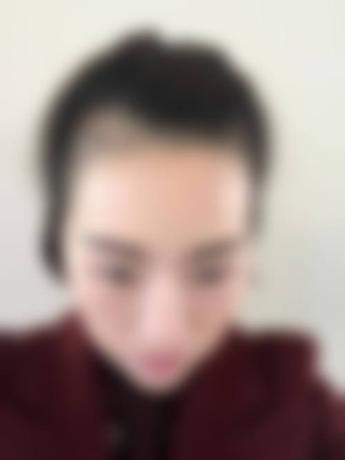 合肥蕥典医疗美容门诊部顾客实例