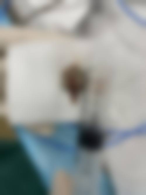 林遐医生项目优势