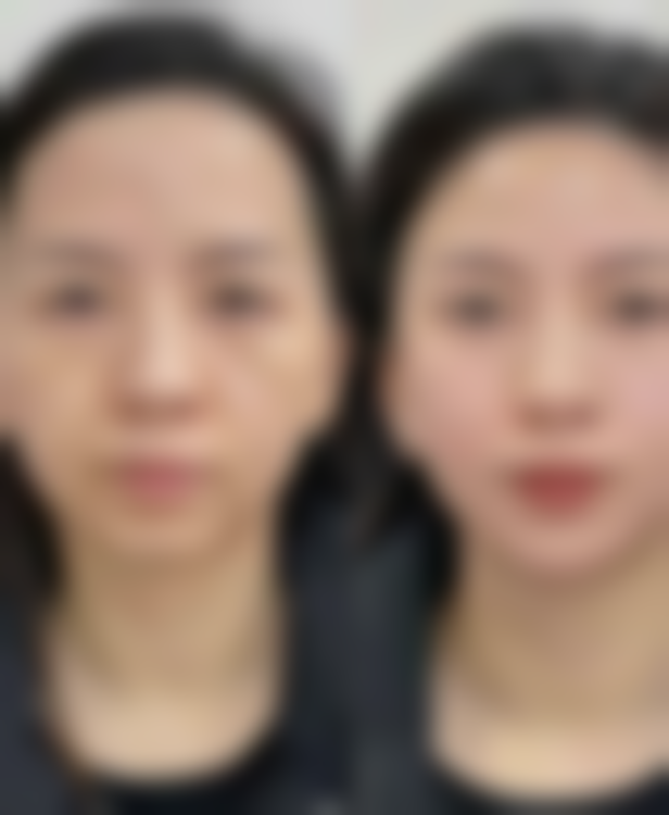 樊辉华医生顾客实例图片
