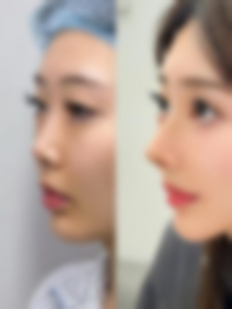 林遐医生做手术价格