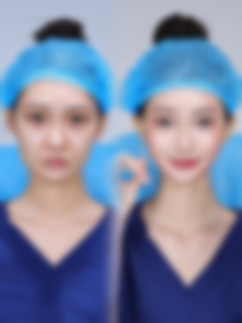 樊辉华医生简介项目优势