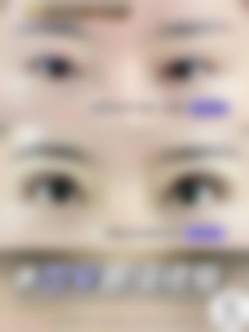 松单项目选择避坑指南