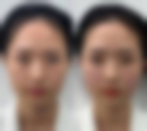 北京普华医疗美容诊所评价