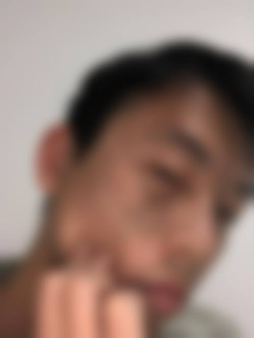 熊明映医生简介做手术价格