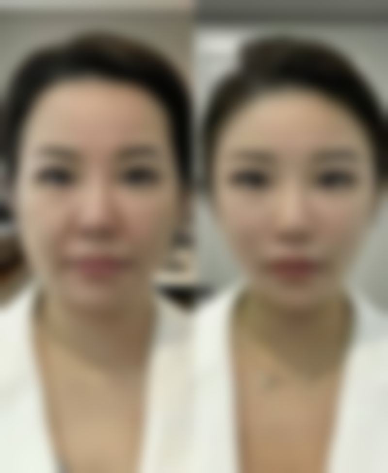熊明映医生简介怎么挂号