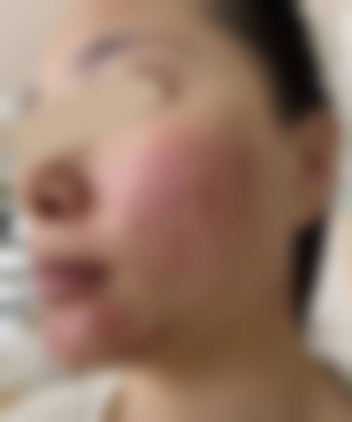 成都锦江艾思汐整形医院项目特色