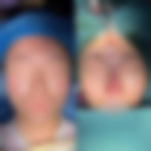 长春市至美医疗美容门诊部顾客实例