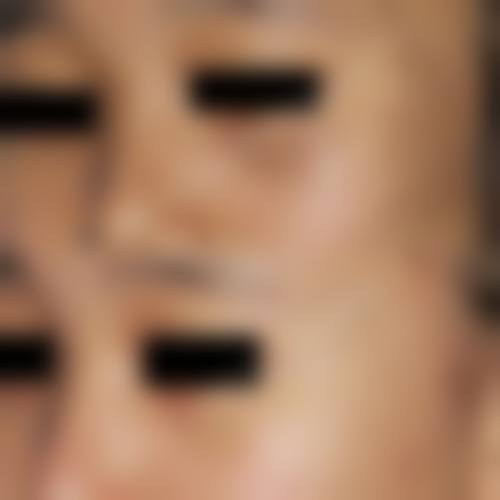 洛阳锐蓓思医疗美容诊所可靠吗