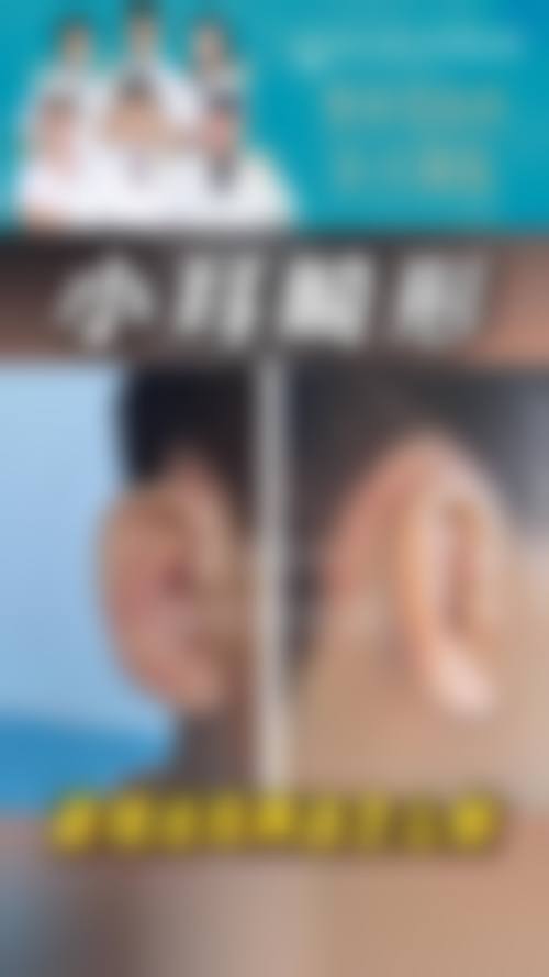 郑荣福医生简介之做手术价格