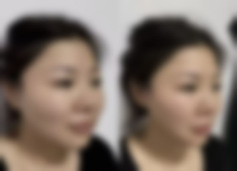 秦皇岛市非常好医院医疗美容科口碑好不好?附真实患者口碑评价