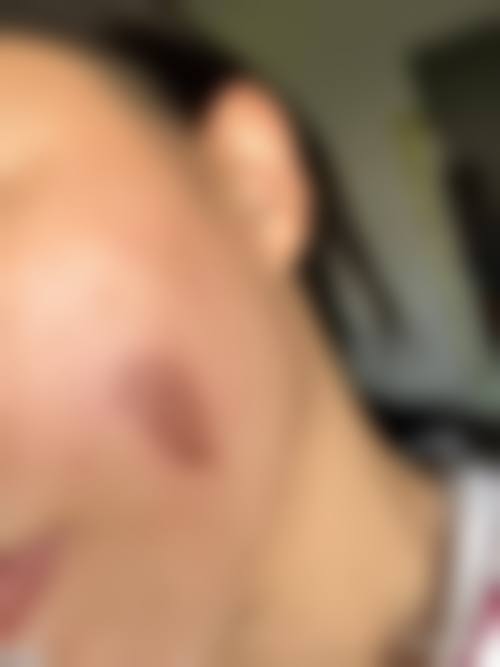 深圳新妍美肌医疗美容诊所更擅长什么手术