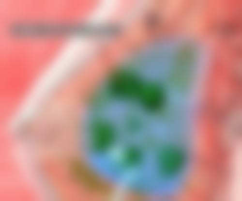 武汉针美荟整形医院怎么样之价格表