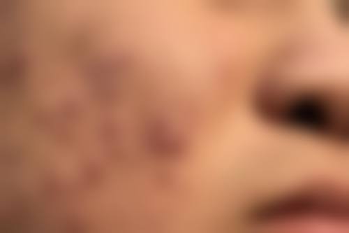 乔福萌医生怎么挂号