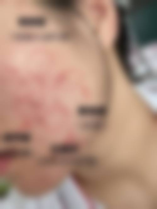 乔福萌医生项目优势