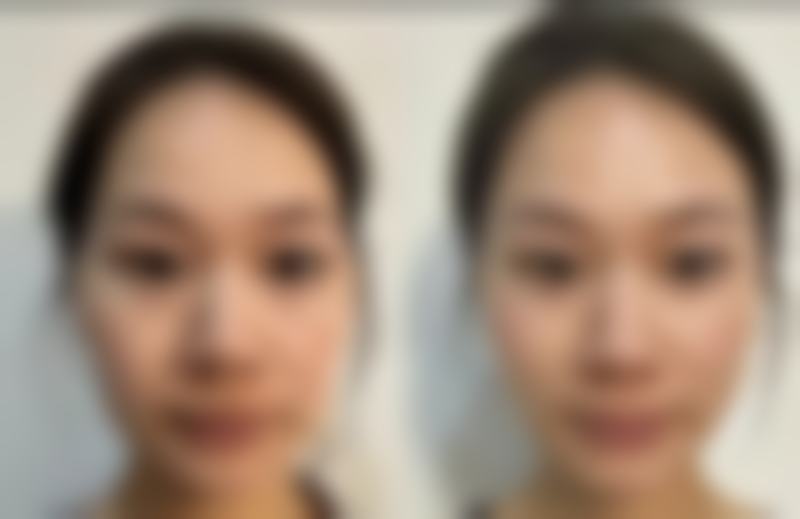 杭州泰美医疗美容诊所怎么样,价格表