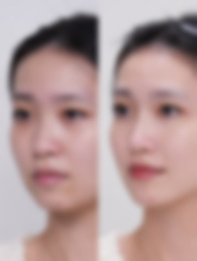 石家庄诚楠整形美容医院怎么样之项目特色