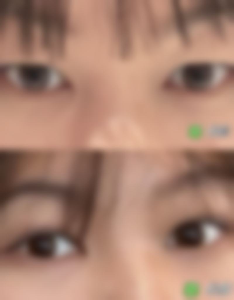 余琦医生简介项目优势