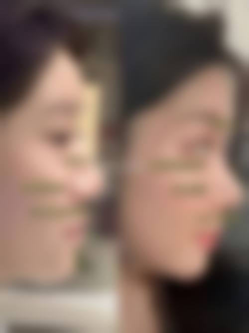 深圳范蔻西医疗美容门诊部特色项目
