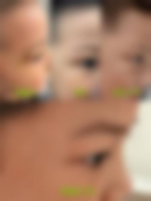 深圳zml医疗美容诊所价格表