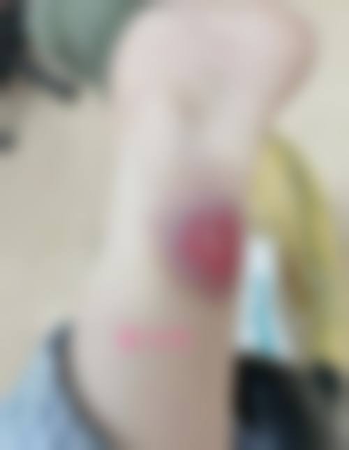 深圳范蔻西医疗美容门诊部顾客实例