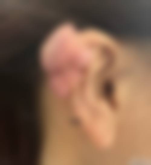 南通英莎医疗美容门诊部李辉手术风格——汇美医学美容诊所