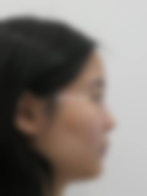 深圳zml医疗美容诊所更擅长什么